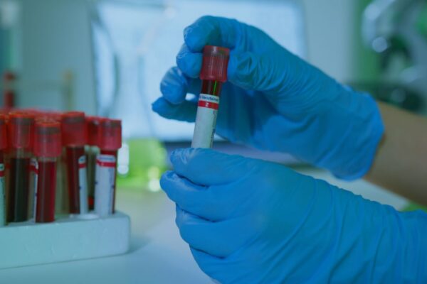 Deficiențele care nu se văd: cum se măsoară lipsa micronutrienților la Clinica Sante